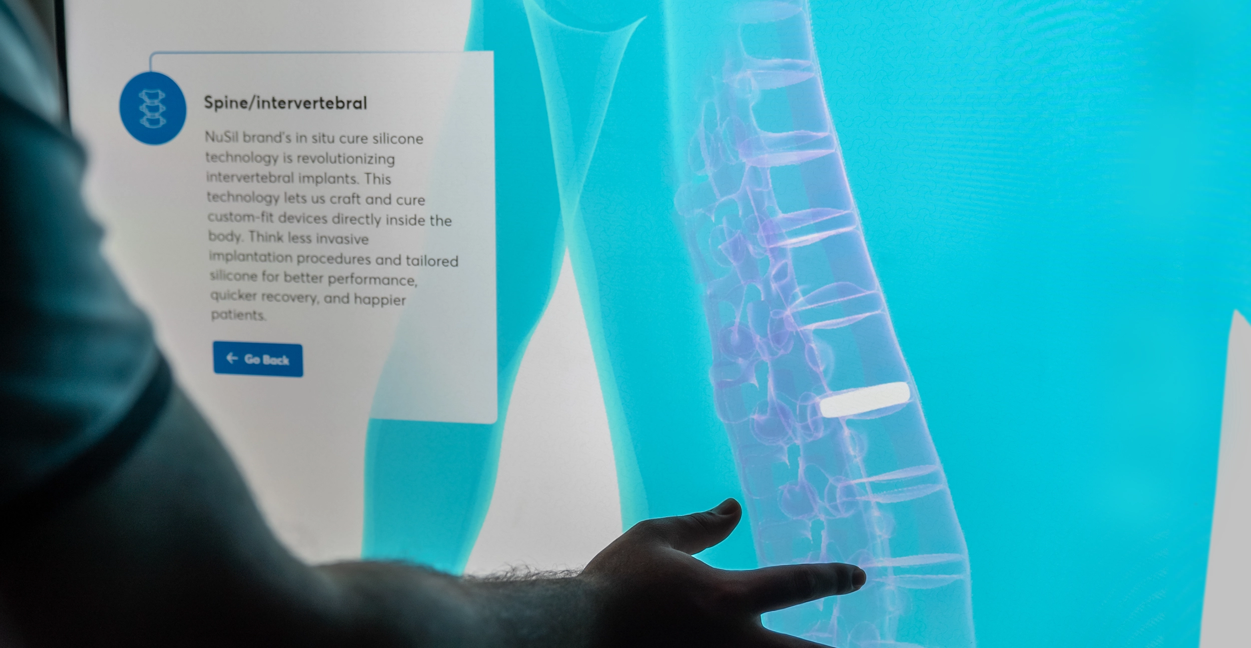 A hand points toward a medical illustration of a human spine displayed on a screen. Text on the screen discusses "Spine/Intervertebral" implants, highlighting new silicone technology for minimally invasive procedures and improved patient recovery.